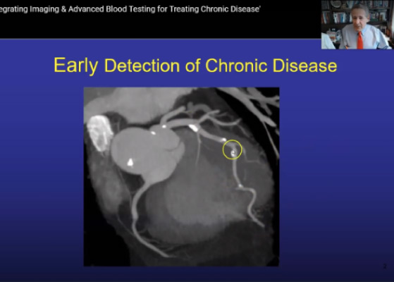 Early Detection of Chronic Disease