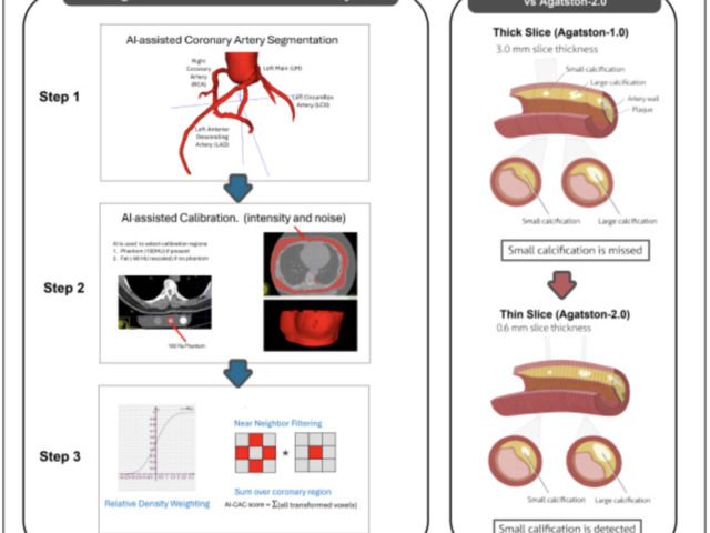 A New Chapter in Coronary Calcium Scoring: Agatston 2.0 and the Future of Heart Disease Prevention